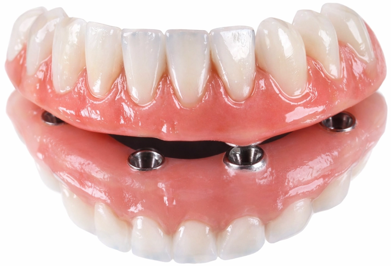 Paciente satisfeita com implante dentário — Sermais Odonto