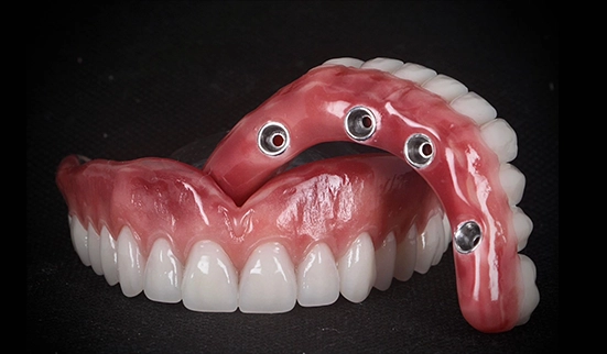 Carga Imediata — Sermais Odonto